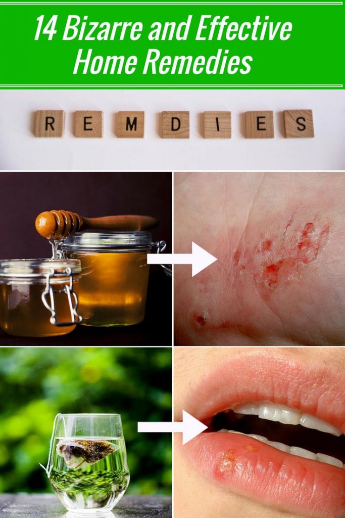 14 Bizarre and Effective Home Remedies
