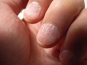 Finger-nails