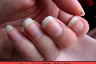 Health WARNINGS Your Fingernails May Be Showing You