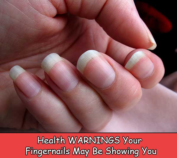 Health WARNINGS Your Fingernails May Be Showing You