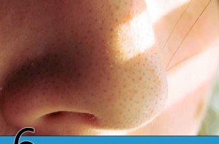 6 Simple, Affordable, and Effective Blackhead Hacks