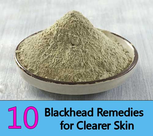  Blackhead Remedies for Clearer Skin