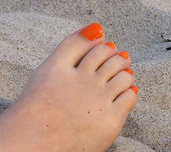 Ingrown Toenails