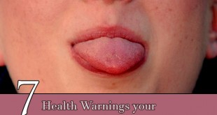Health Warnings your Tongue May Be Telling You