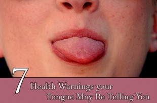 Health Warnings your Tongue May Be Telling You