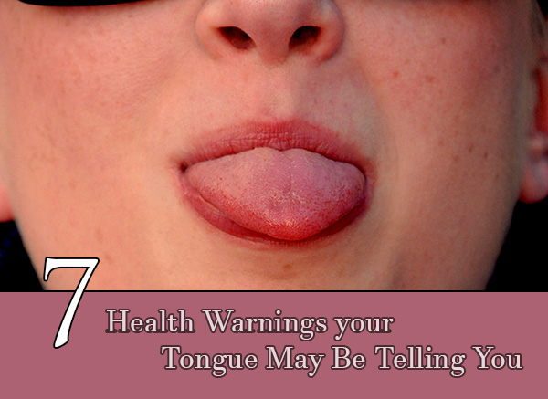 Health Warnings your Tongue May Be Telling You