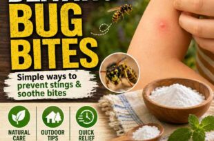 Beating Bug Bites