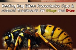 Beating Bug Bites: Preventative Care and Natural Treatments for Stings and Bites