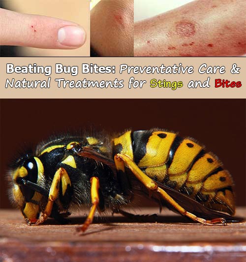 Beating Bug Bites: Preventative Care and Natural Treatments for Stings and Bites