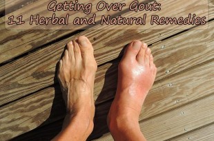Getting Over Gout: 11 Herbal and Natural Remedies