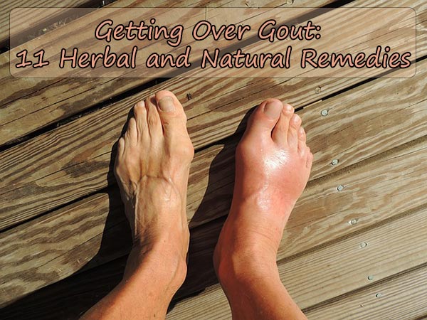 Getting Over Gout: 11 Herbal and Natural Remedies