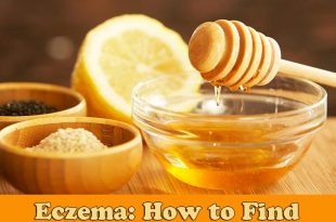 Eczema: How to Find Reliable Natural Relief