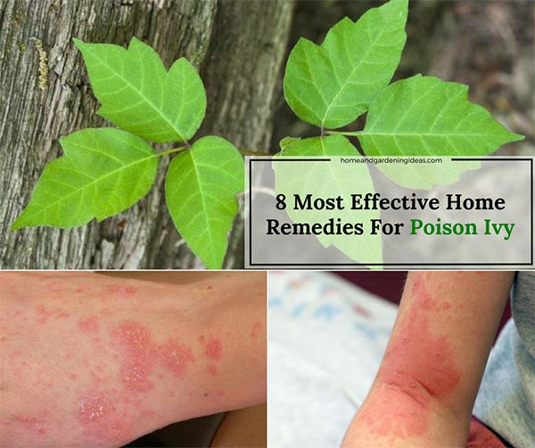 Poison Ivy Home Remedies: 8 Most Effective Remedies For Poison Ivy