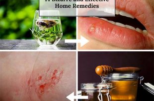 14 Bizarre and Effective Home Remedies