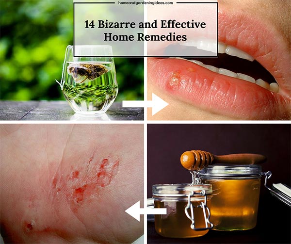 14 Bizarre and Effective Home Remedies
