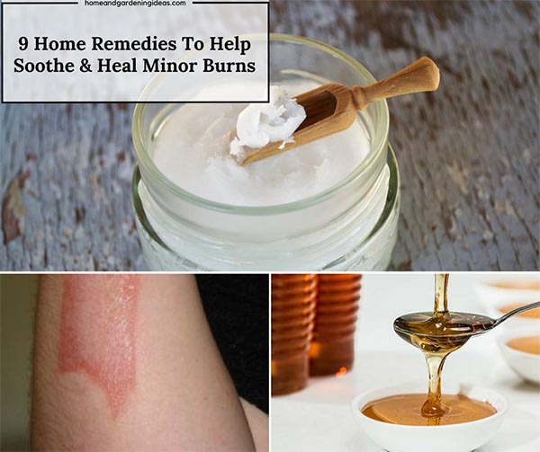 9 Home Remedies To Help Soothe & Heal Minor Burns