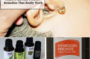 Remove Earwax 6 Home Remedies That Really Work