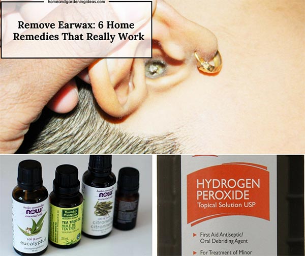 Remove Earwax 6 Home Remedies That Really Work Home And Gardening Ideas