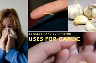 15 Clever and Surprising Uses for Garlic