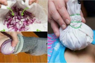 11 Crazy Home Remedies Using Onions That Really Work