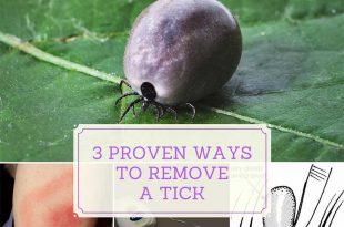 3 Proven Ways to Remove a Tick