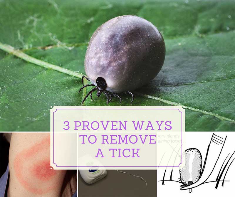 3 Proven Ways to Remove a Tick