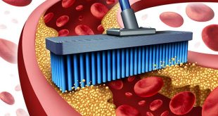 13 Foods to Eat to Reduce Clogged Arteries
