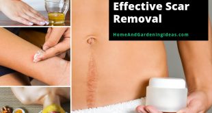9 Natural Home Remedies for Effective Scar Removal