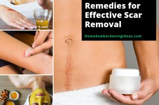 9 Natural Home Remedies for Effective Scar Removal