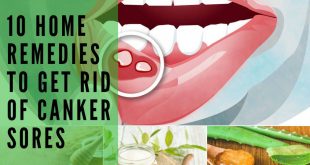 Home Remedies to Get Rid Of Canker Sores