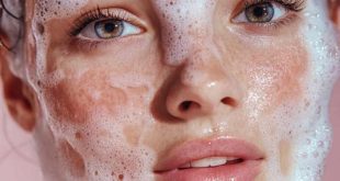 8 Easy Tricks to Get Rid of Pesky Pimples