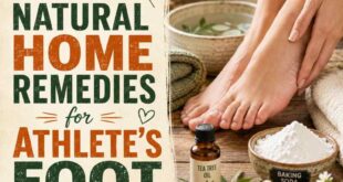 10 Natural Home Remedies for Athlete’s Foot