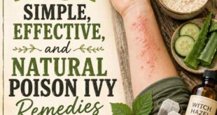 16 Simple, Effective, and Natural Poison Ivy Remedies