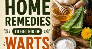 8 Natural Home Remedies To Get Rid of Warts
