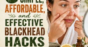 6 Simple, Affordable, and Effective Blackhead Hacks