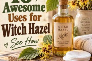 16 Awesome Uses for Witch Hazel