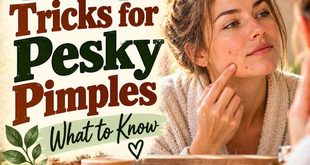 8 Easy Tricks to Get Rid of Pesky Pimples